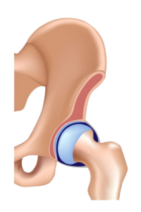 Diagram of a healthy hip joint