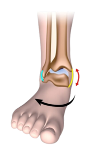 Diagram showing an eversion ankle sprain
