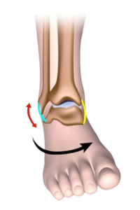 Diagram showing an inversion ankle sprain