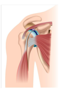 Diagram of a normal shoulder